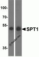 Spt1