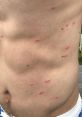 Itch Itchy skin. The mere mention of those words instantly conjures up an image of relentless discomfort, the incessant need